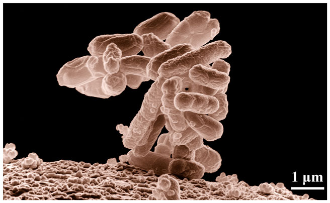 Hình dạng vi khuẩn Coliform Bacteria Hình dạng vi khuẩn Coliform Bacteria